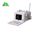 Analizzatore umano di ultrasuono dell'attrezzatura medica di ultrasuono di Digital con esposizione LCD fornitore